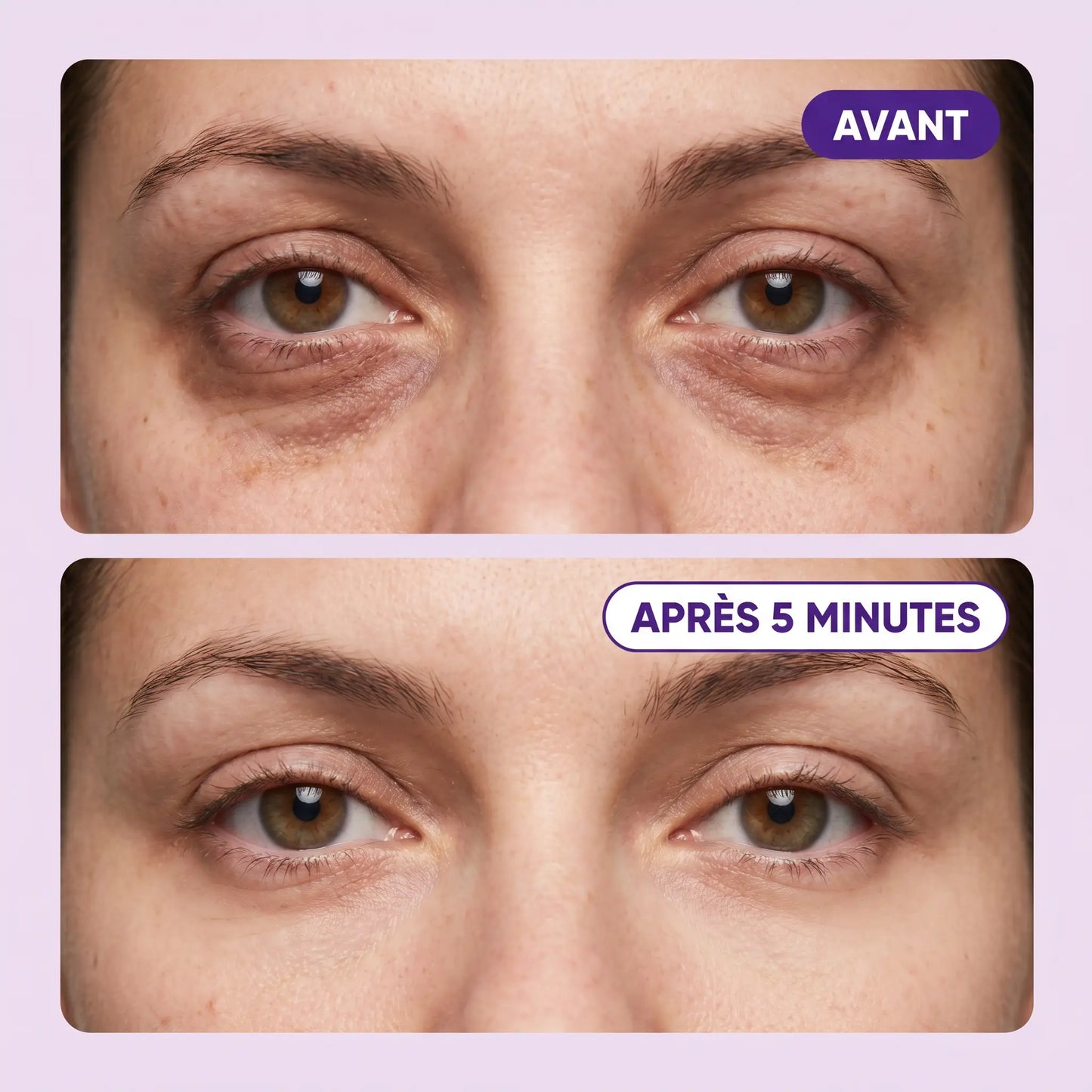 LORAYAH — Le soin regard qui change tout